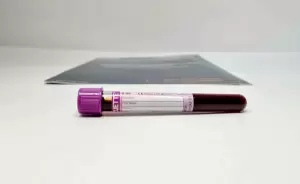 Фотография ДНК 42 3