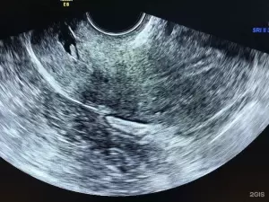 Фотография Кабинет УЗИ 1